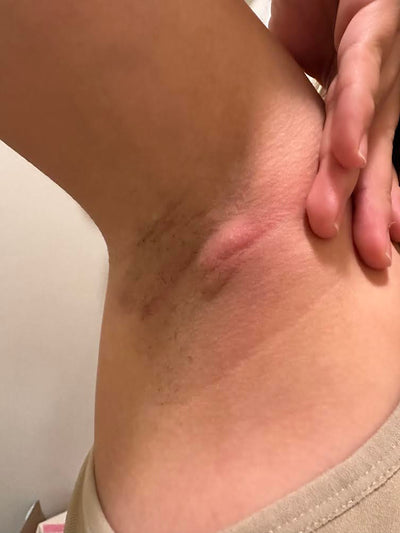 Day 1