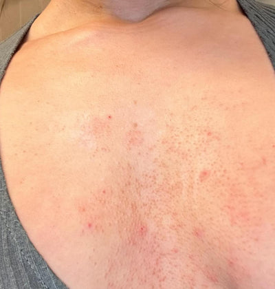 Day 1