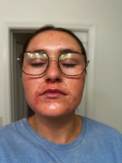 Week 1