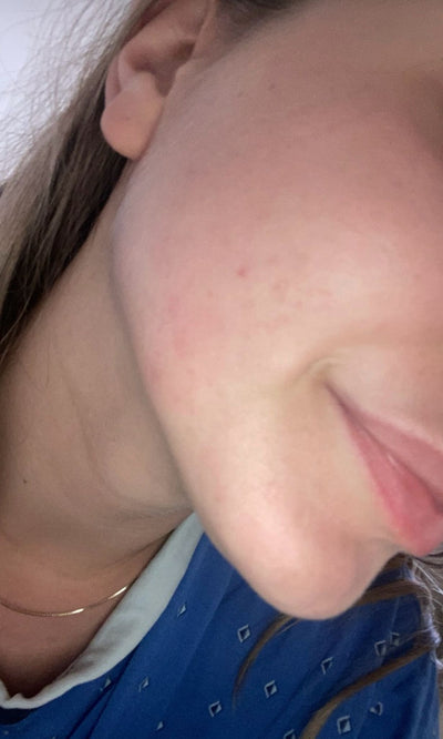 Month 4