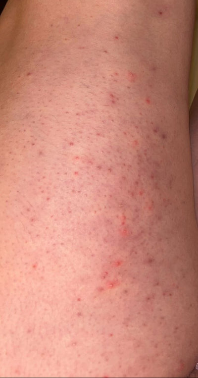 Day 1