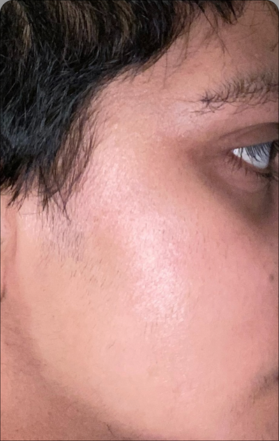 Day 14