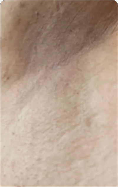 Day 12