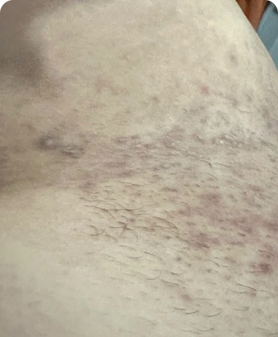 Day 1
