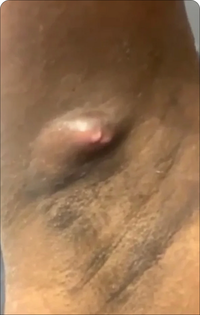 Day 1