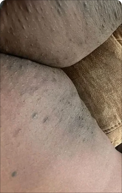 Month 1