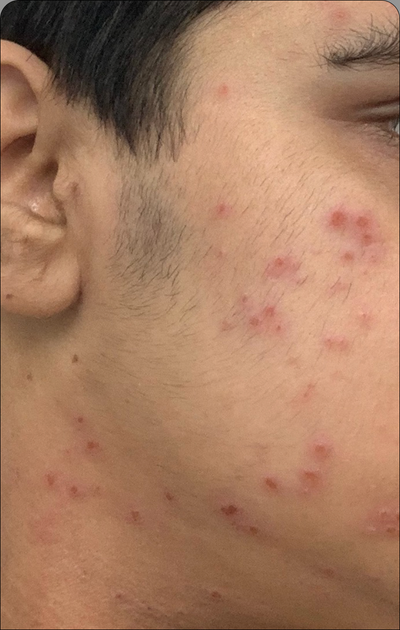 Day 1
