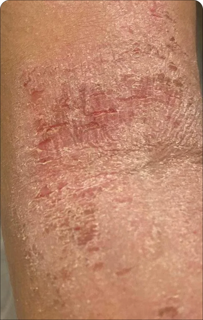 Day 1