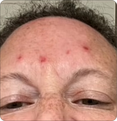 Day 1