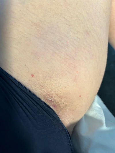 Day 6