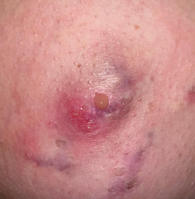 Day 1