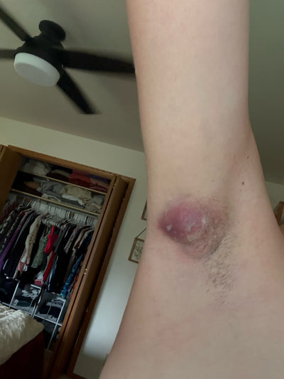 Month 1