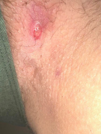Week 1