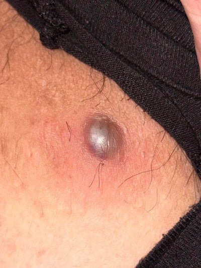 Day 1