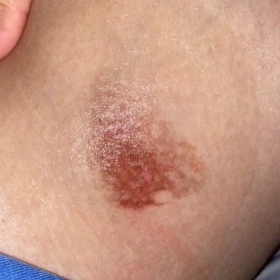 Day 1