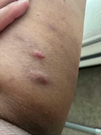 Day 1