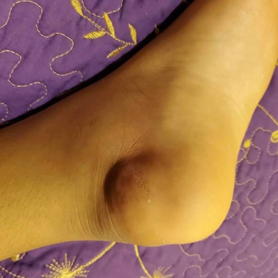 Day 1