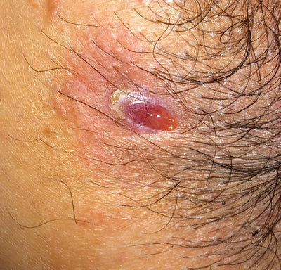 Day 1