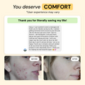 2-Step Acne Routine