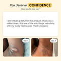 Best Flare Care Deal: Ultimate Healing Pack