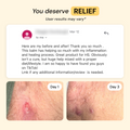 Best Flare Care Deal: Ultimate Healing Pack