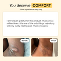 Universal Flare Care
