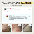 Best Flare Care Deal