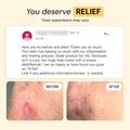 Universal Flare Care