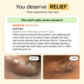 Universal Flare Care | Essential Oil Free