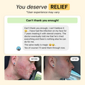 Folliculitis Flare Care Control