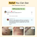 Best Flare Care Deal: Ultimate Healing Pack