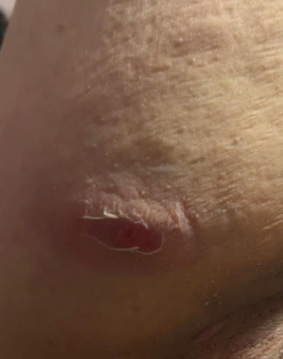 Day 1