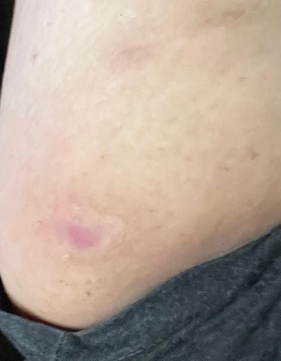 Day 11