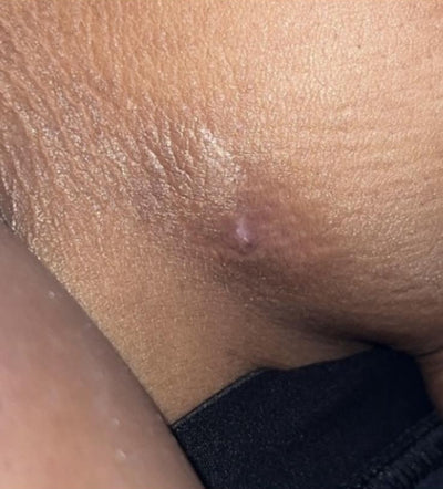 Day 6
