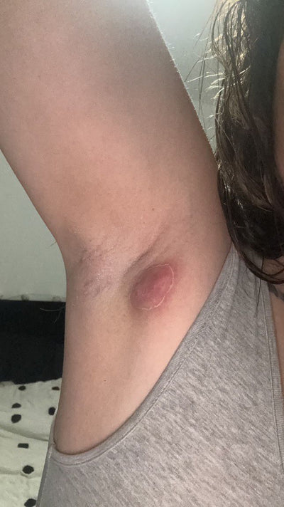 Day 1