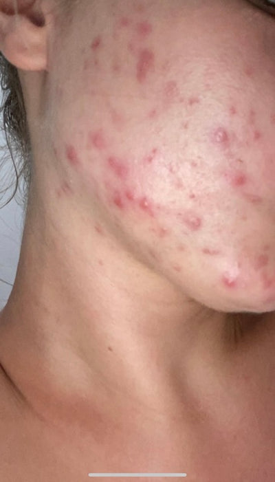 Month 1