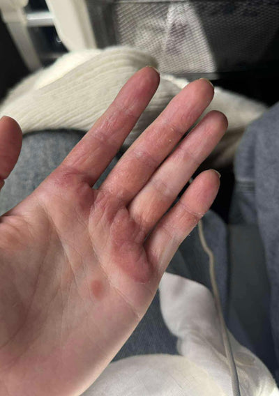 Day 1