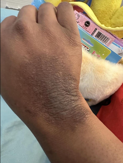 Day 1