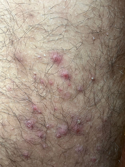 Day 1