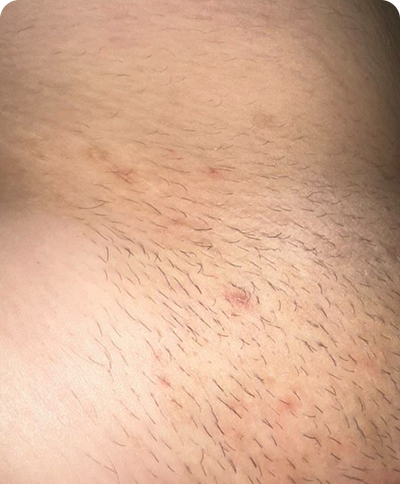 Day 2