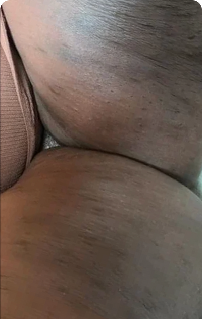 Month 2