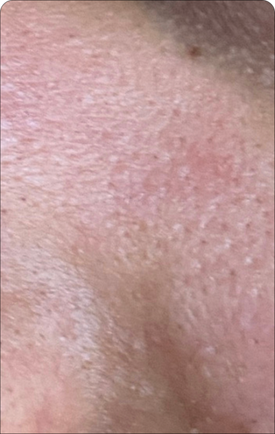 Day 5