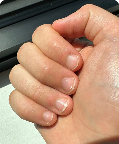 Day 3