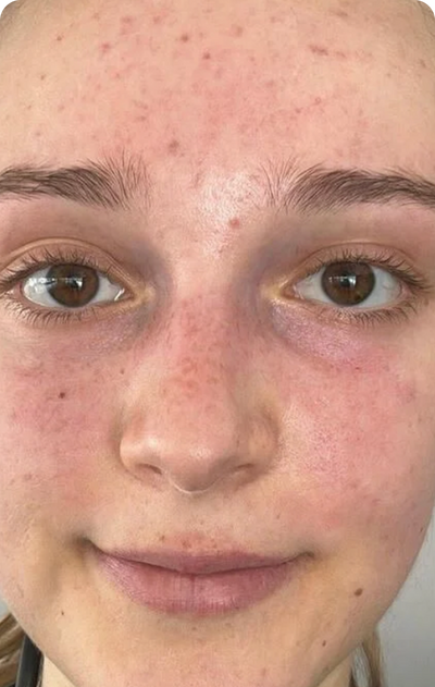 Day 6
