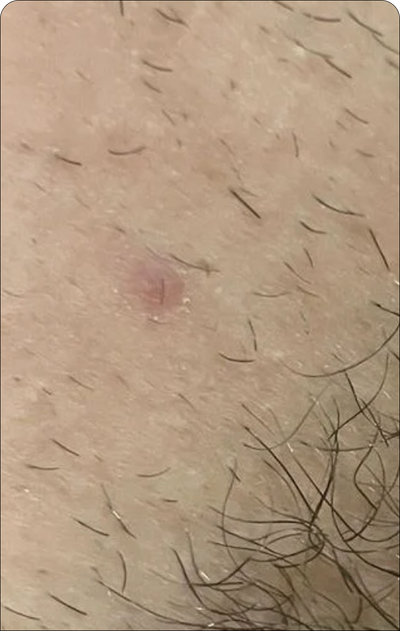 Day 2