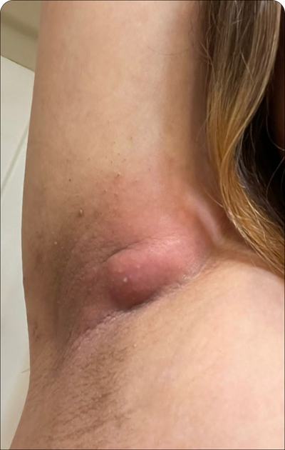 Day 1