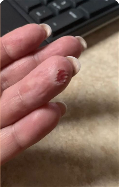 Day 1