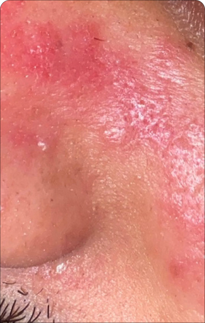 Day 1