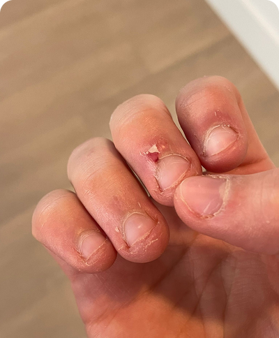 Day 1