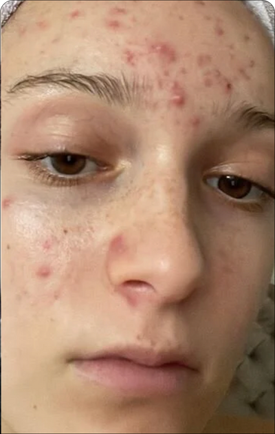 Day 1